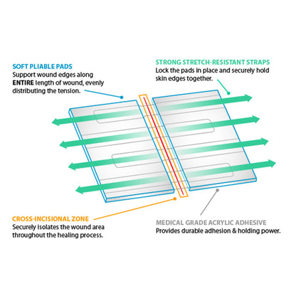 Emergency Laceration Closures, 2 Pack (25mm or 40mm)