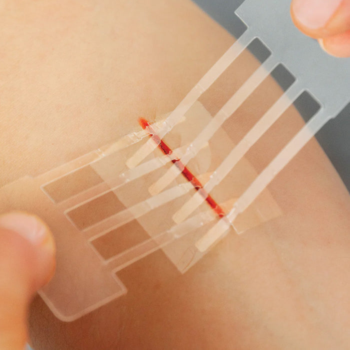 Emergency Laceration Closures