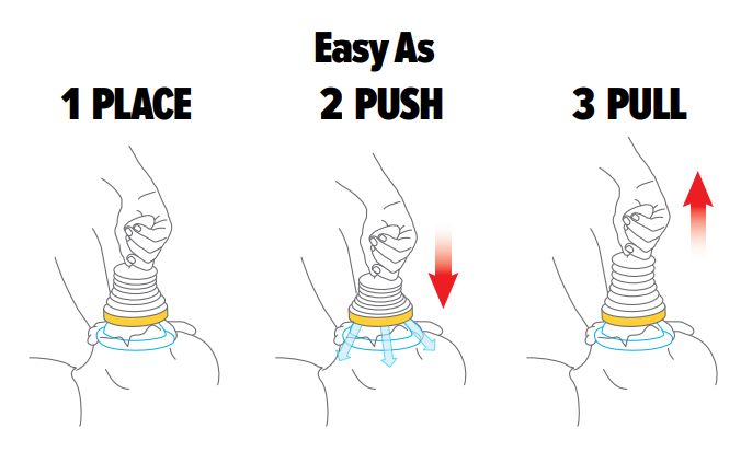 LifeVac Kit Instructions