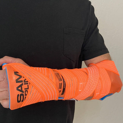 SAM Splint Combo Pack, in use on arm