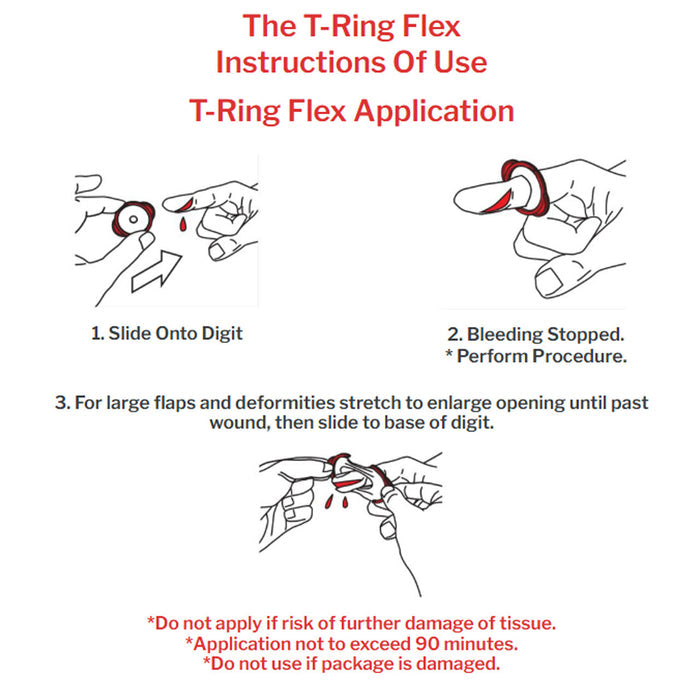 T-Ring Flex