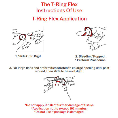 T-Ring Flex